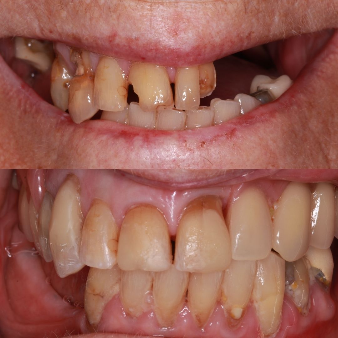 Links Dental Practice | Request A Complimentary Consultation Before and after treatment at Links Dental Practice in Edinburgh