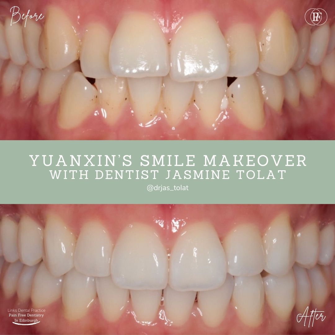 Links Dental Practice | Straight Teeth System Links Dental Practice | Straight Teeth System
